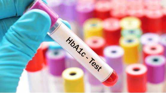 O que é o teste de hemoglobina glicada (HbA1c)?